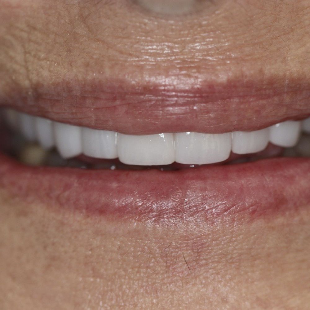 Top Cosmetic Dentist in Spring Creek Parkway Area