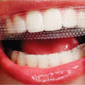Best Cosmetic Dentist in Highland Hills San Antonio Texas