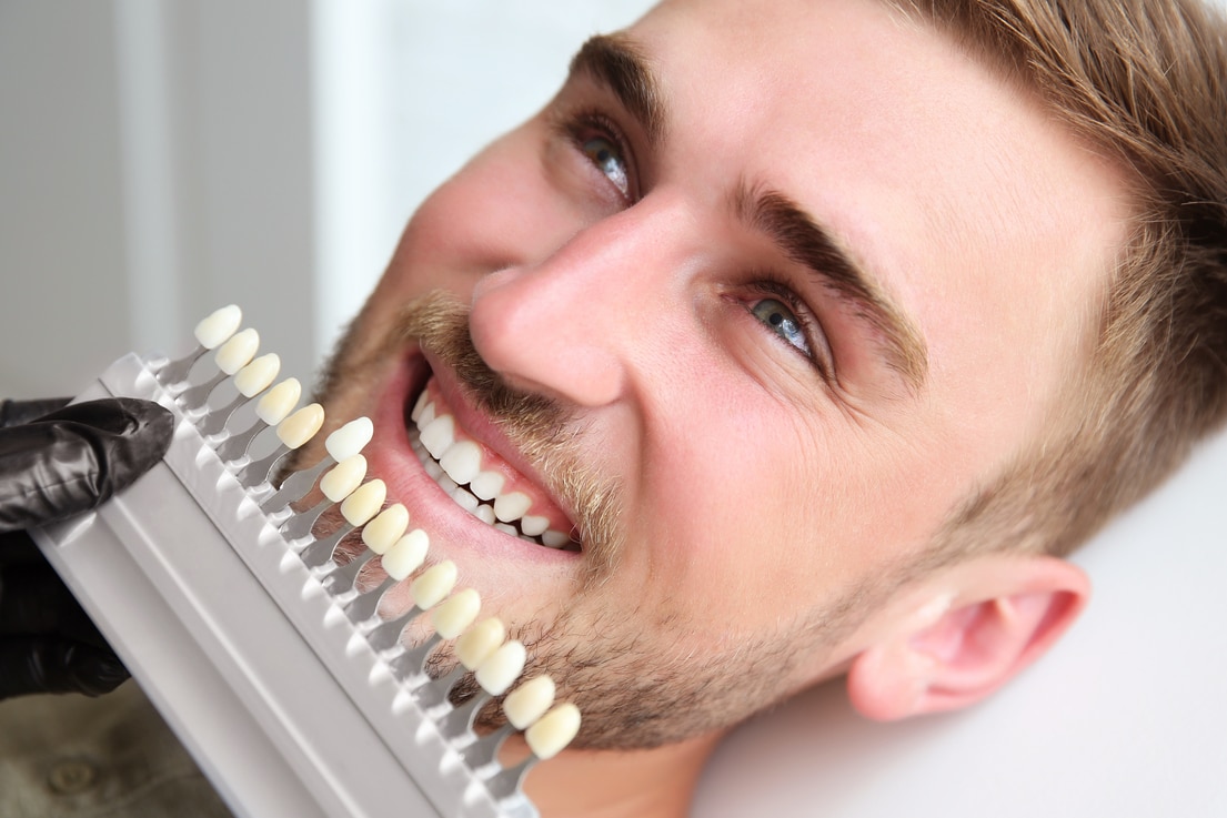 Is Teeth Bleaching Safe Is Teeth Bleaching Safe