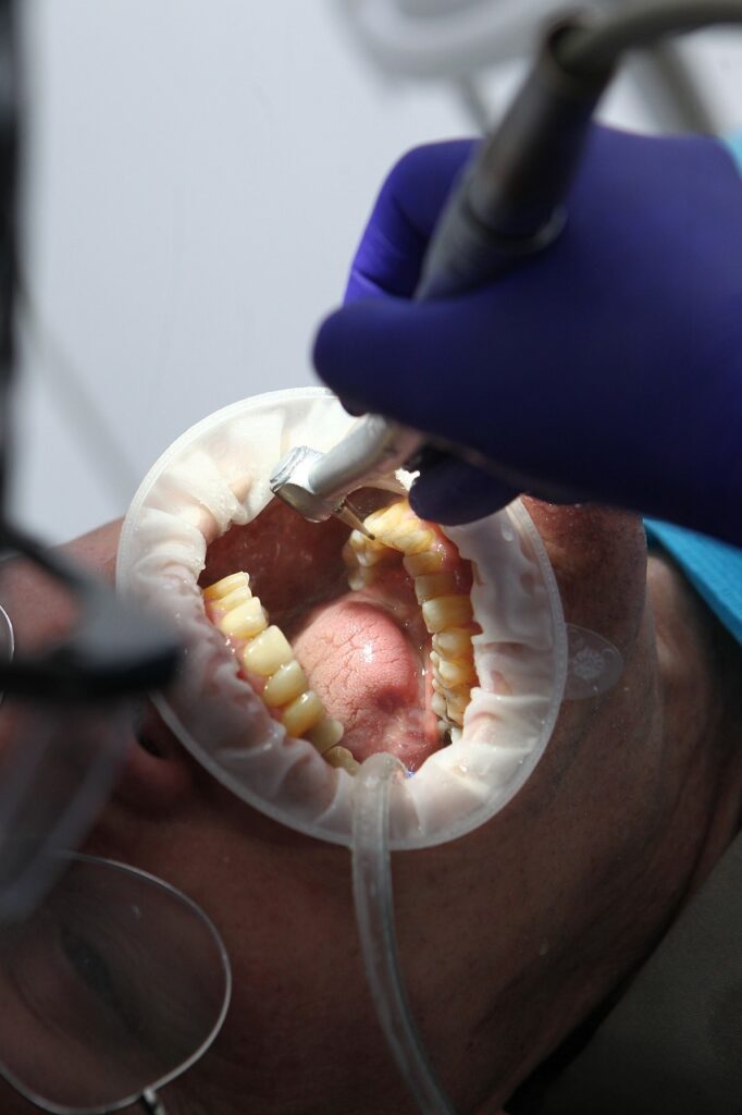Cosmetic Dentist In Port Orange Florida 4 Cosmetic Dentist In Port Orange Florida