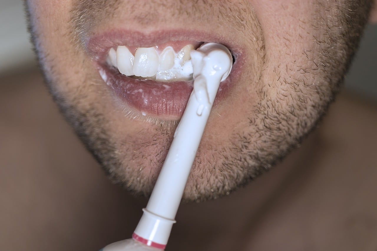 Steps Of Bleaching Teeth