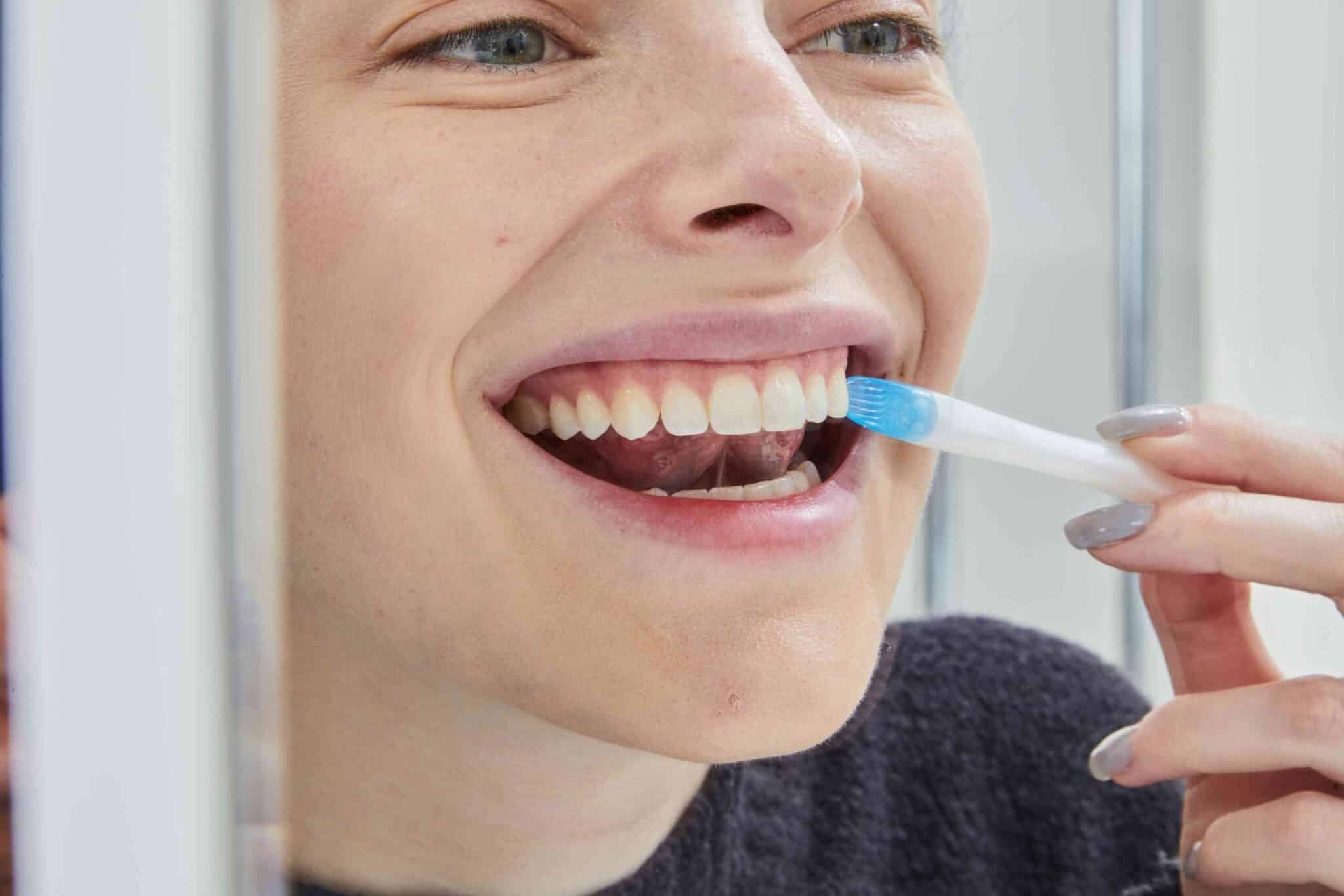 What Teeth Whitening Works Best What Teeth Whitening Works Best