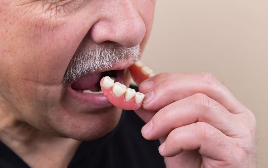 The Price of a Perfect Smile Cosmetic Dentistry Costs 2