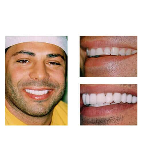 Cosmetic Dentist In Harbor Beach Lauderdale Florida Fla FL