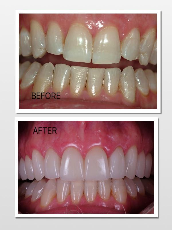 Cosmetic Dentist In Riverwalk Lauderdale Florida Fla FL Cosmetic Dentist In Riverwalk Lauderdale Florida Fla FL