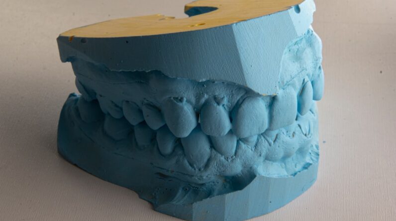 Photo Teeth whitening