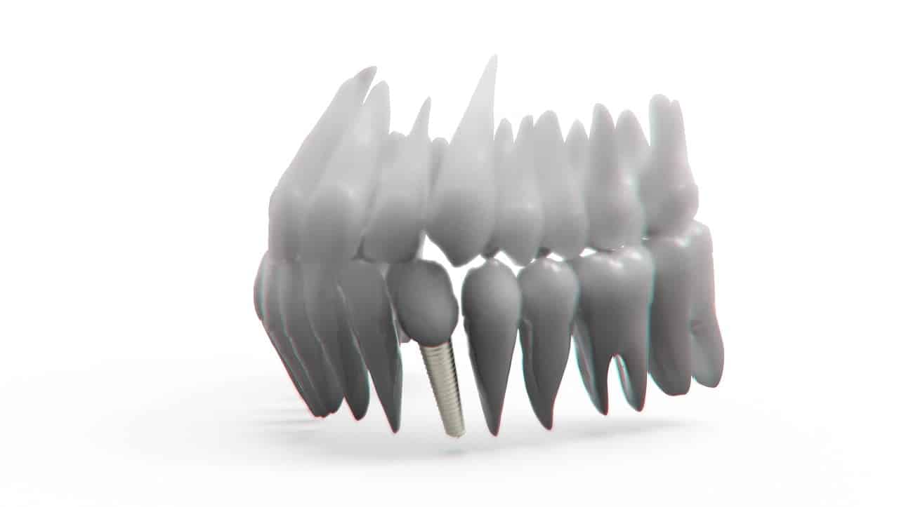 How Cosmetic Dentists Can Correct Crooked Teeth How Cosmetic Dentists Can Correct Crooked Teeth