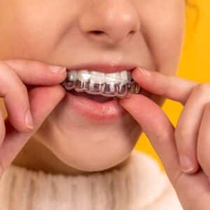 Photo Dental implants