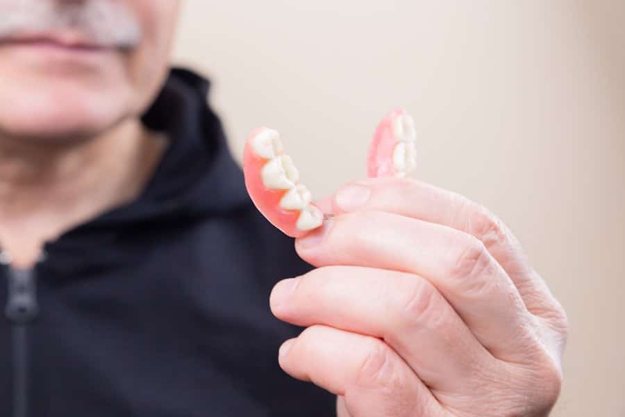 Smile Makeover Process Explained 1