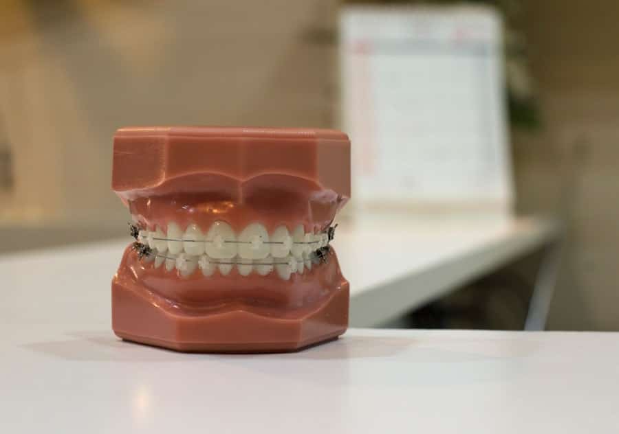 Dental Contouring Near Me 1