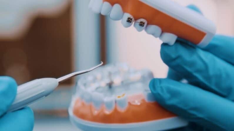 Photo Teeth whitening