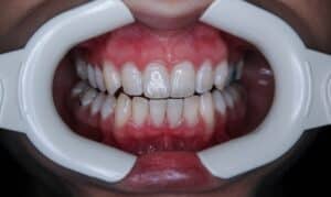 Cosmetic Dentists For Bad Breath Work