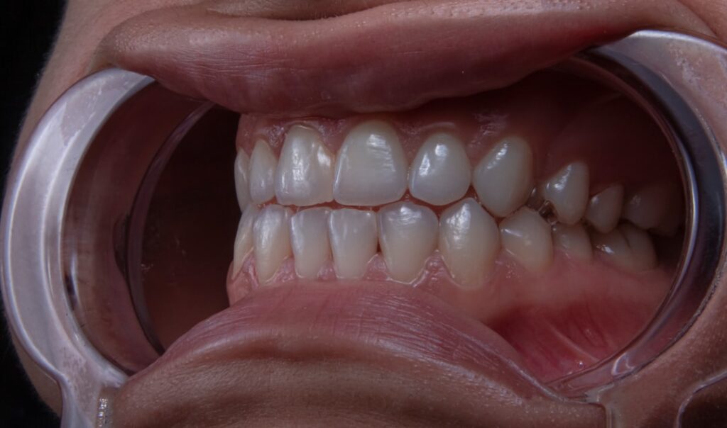 Cosmetic Dentist In Firestone Park Akron Ohio OH 1 Cosmetic Dentist In Firestone Park Akron Ohio OH
