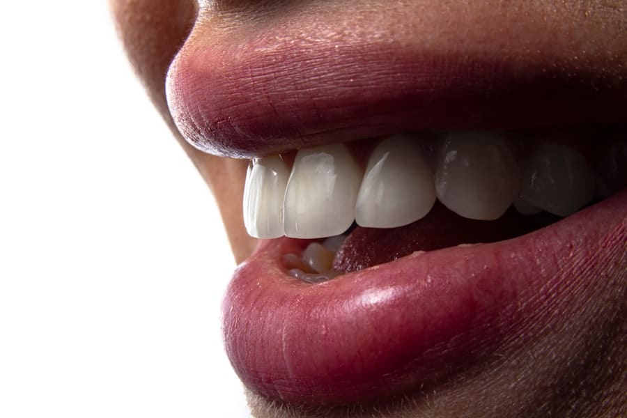 Best Implant Dentist In Houston 1