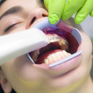 Photo Teeth whitening