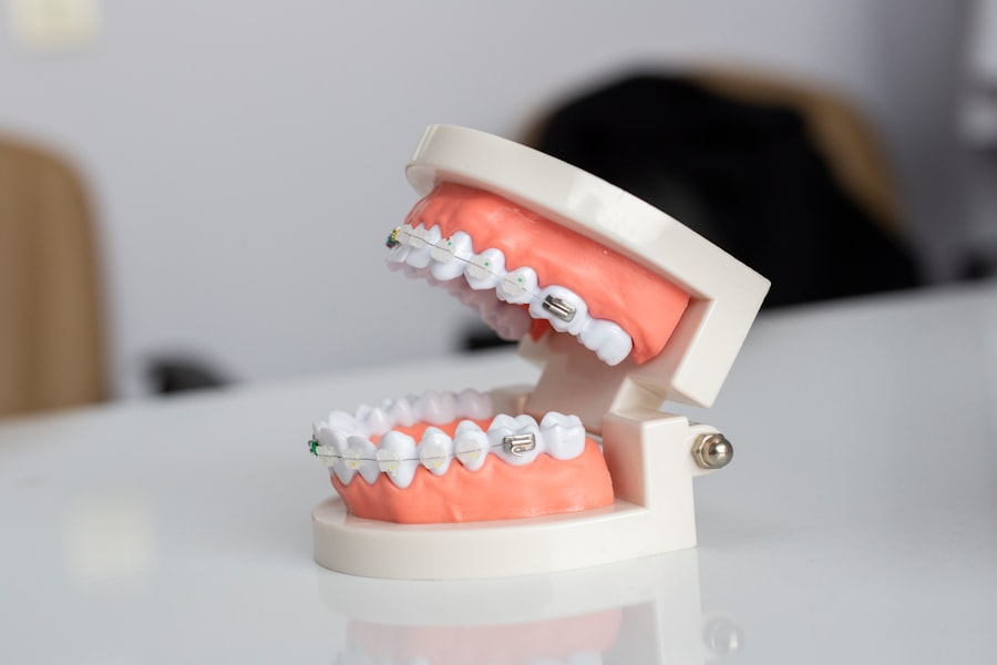 Cosmetic Dentist in Fremont