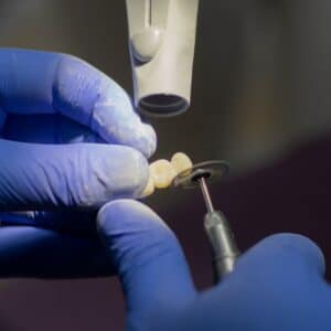 Photo Teeth whitening