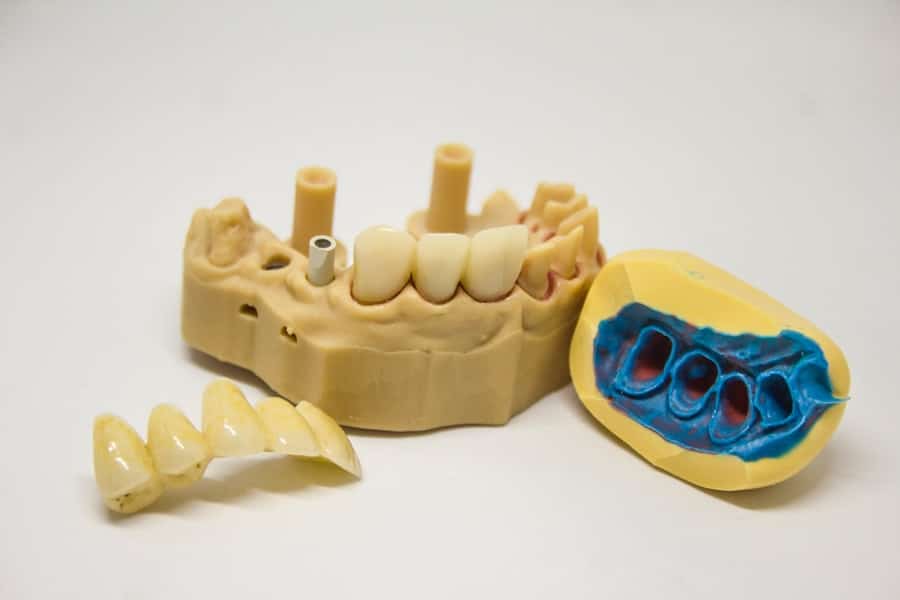 Best Implant Dentist In Houston 2