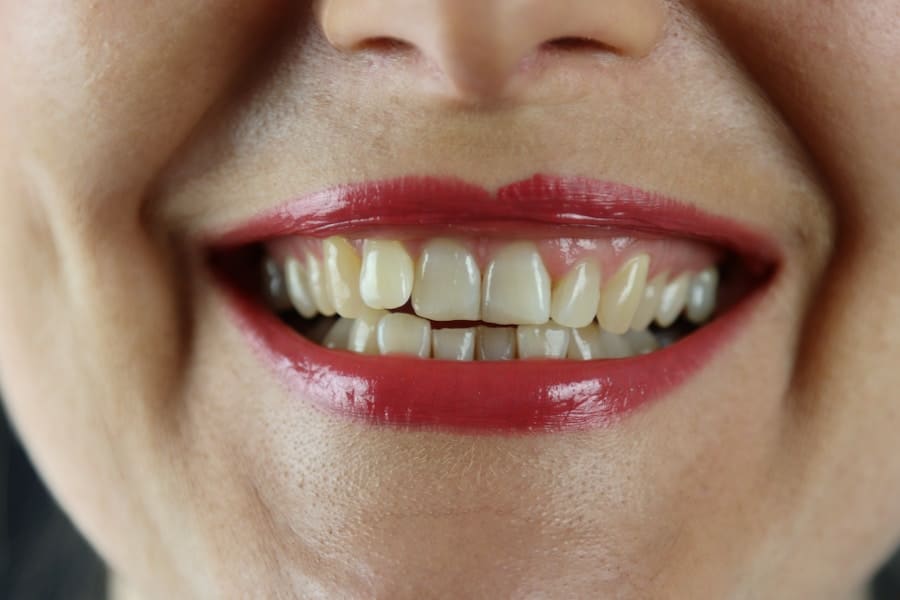 Best Cosmetic Dentist Queensland 2