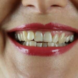 Photo "Cosmetic Dental Implants Near Me"