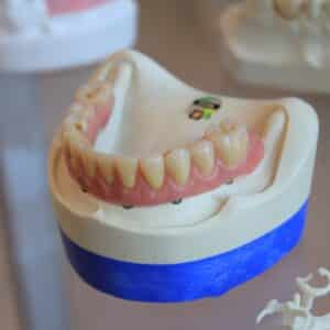 Photo Cosmetic Dental Filling