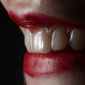 Photo "Cosmetic Dental Bonding Before and After"