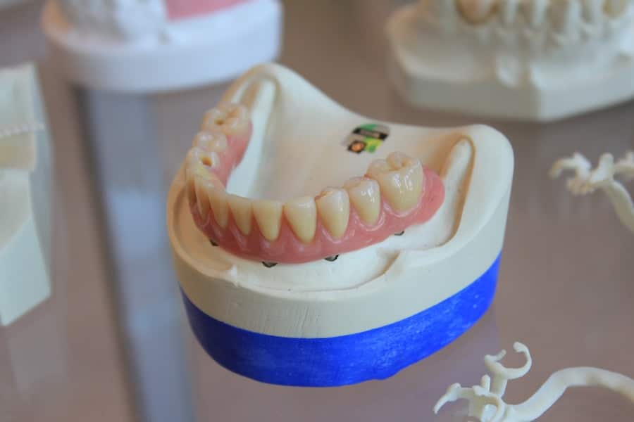 Cosmetic Dental Cost 2