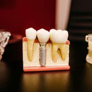 Photo Cosmetic Dental Options