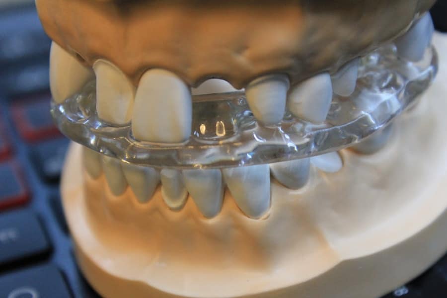 Cosmetic Dental Options 2
