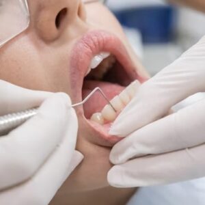 Best Cosmetic Dentist in Camelot I & II San Antonio Texas