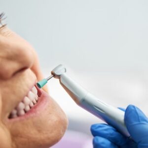Best Cosmetic Dentist in Randolph AFB Area San Antonio Texas