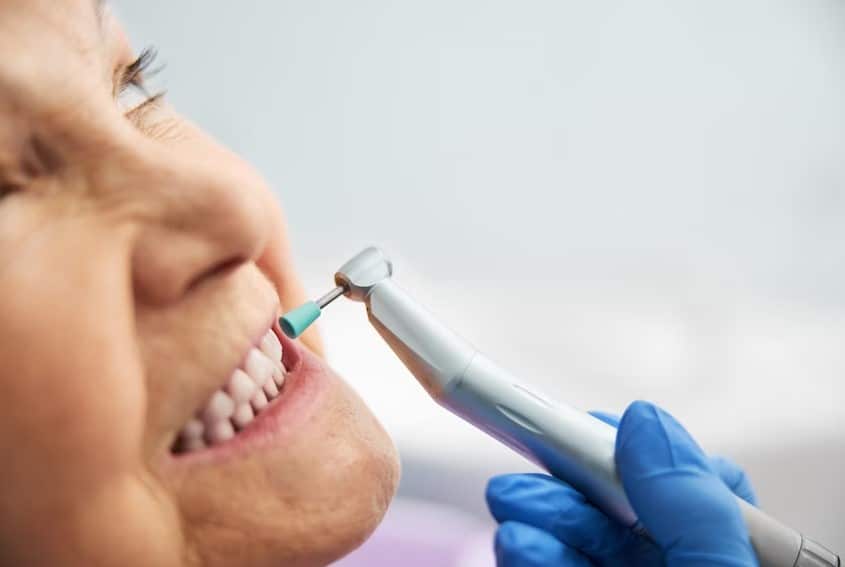 Best Cosmetic Dentist in Randolph AFB Area San Antonio Texas