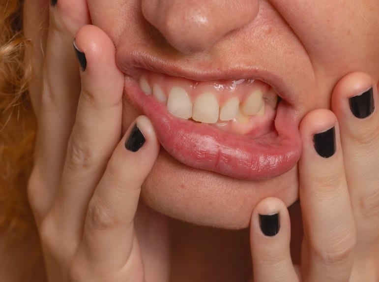 Best Cosmetic Dentist in Woodlake San Antonio Texas