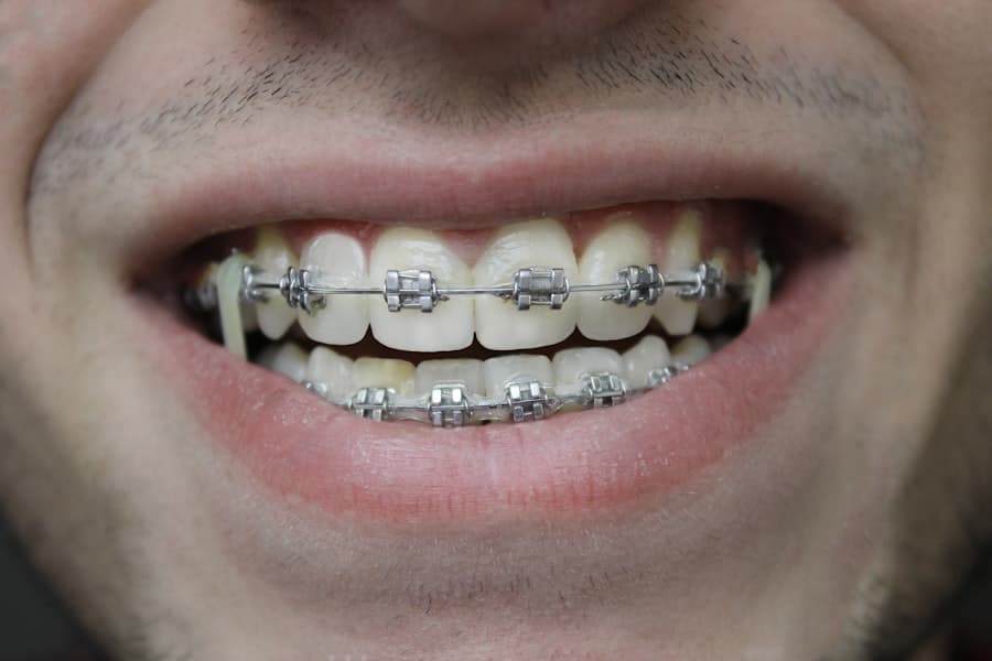 Fix Teeth Parma Oh 1 Teeth Fix