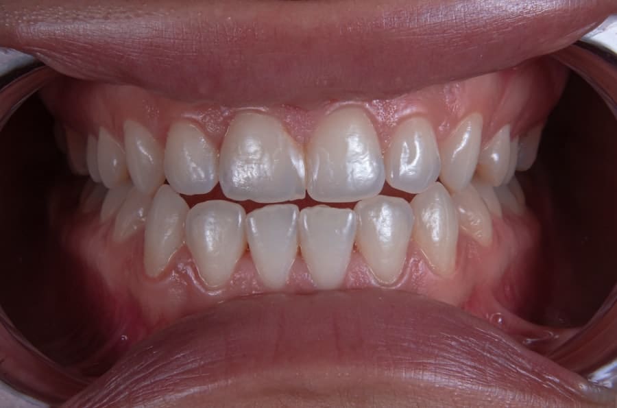 Cosmetic Dentist Rocklin