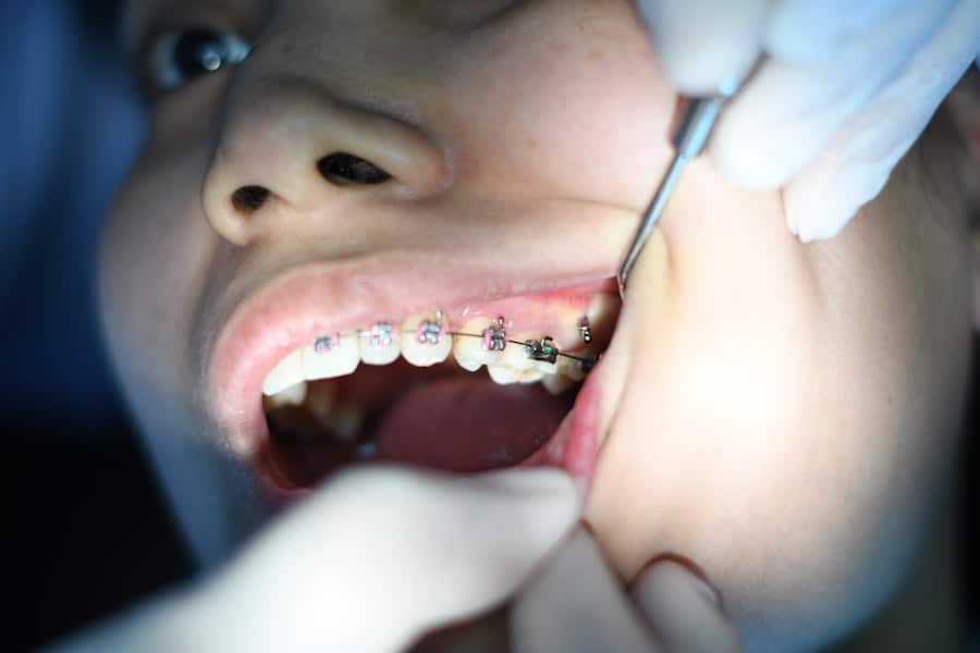 Cosmetic Dentistry Newton 1 Cosmetic Dentistry Newton