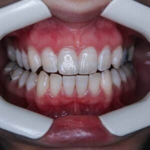 Photo Cosmetic Dentistry Chico