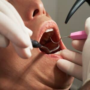 Photo Cosmetic Dentistry Melbourne Fl