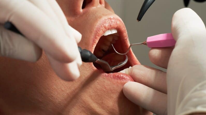 Photo Cosmetic Dentistry Melbourne Fl