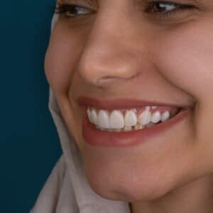 Photo Cosmetic Dentist Murrieta