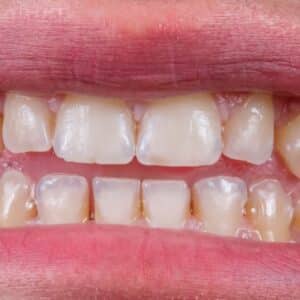 Photo Cosmetic Dentist Pearland Texas