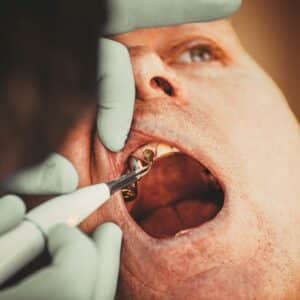 Photo Cosmetic Dentist