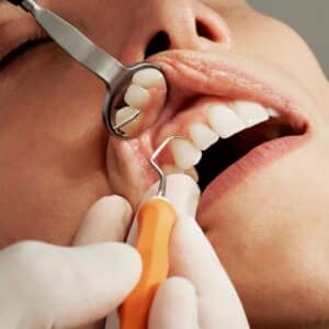 Photo Cosmetic Dentist