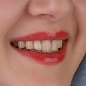 Photo Cosmetic Dentist