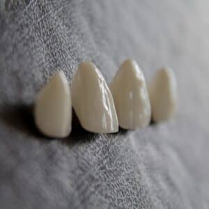 Photo Teeth Whitening St Cloud Mn