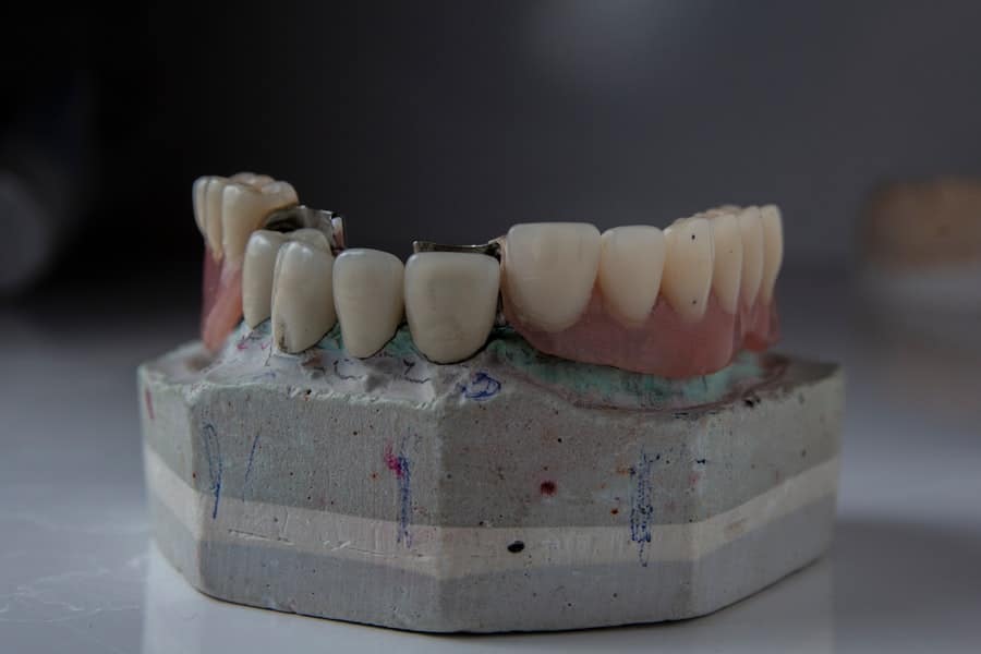 Fix Teeth Parma Oh 2 Photo Teeth Fix