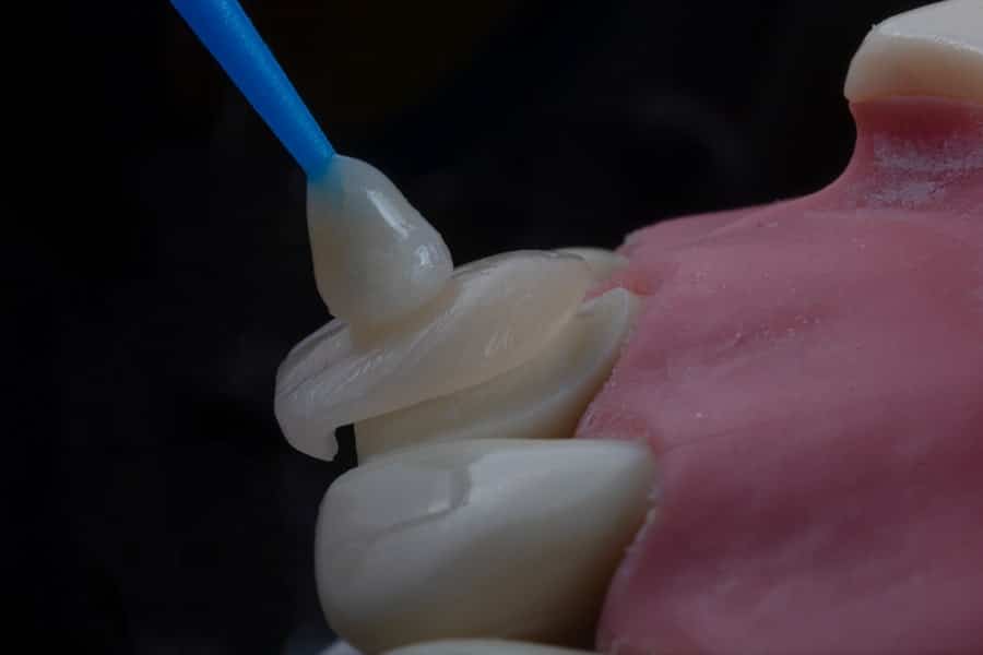 Gum Surgery Killearn Estates 2 Photo Gum Surgery Killearn Estates