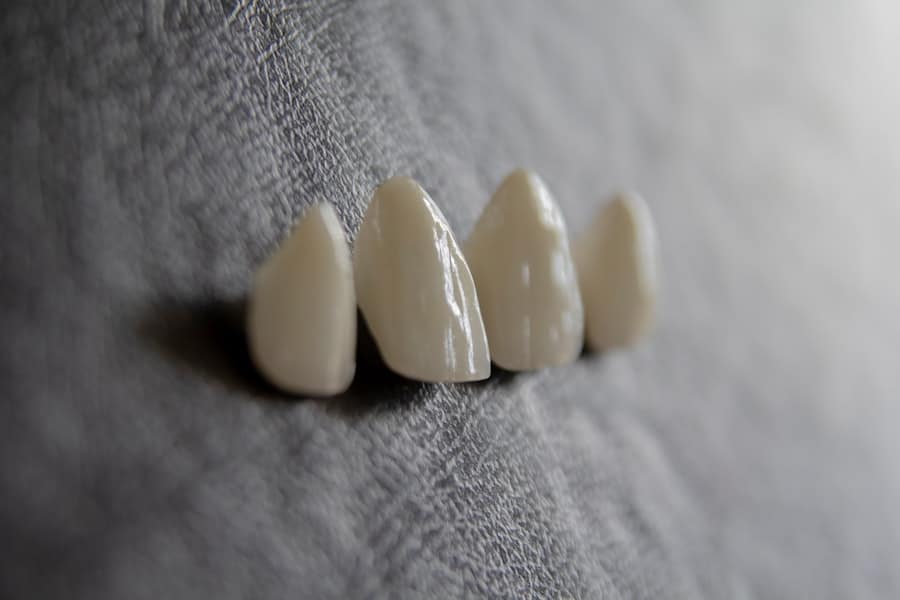 Photo Whiten Your Teeth