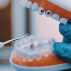 Photo Laser Whitening