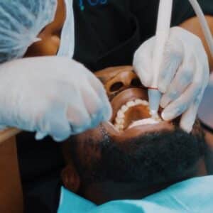 Photo Laser Whitening